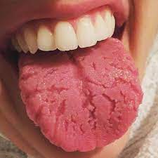 healthy tongue